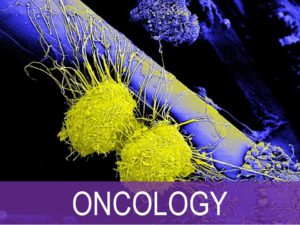 Oncology photo